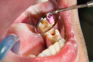 Read more about the article What does orthodontic do?