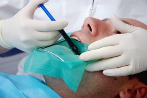 Read more about the article Root Canal Treatment: What Are the 3 Stages of Root Canal Treatment?